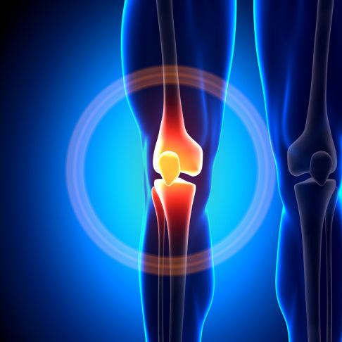 KneeBoost™ Ondersteunende Kniebrace| geeft jouw knie 99% extra steun.